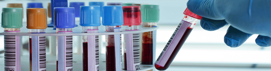 Blood samples 2 - front page