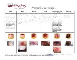 Pressure Ulcer Stages relate to Degree of Harm in BC PSLS
